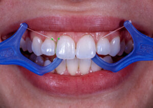 Diş ipi nasıl kullanılır